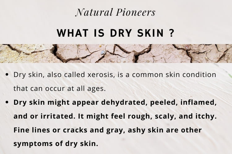 Natural Pioneers Best Bath Salt For Dry Skin What is dry skin