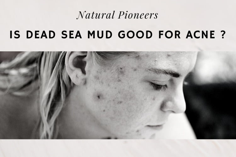 Natural Pioneers Is Dead Sea Mud Good For Acne